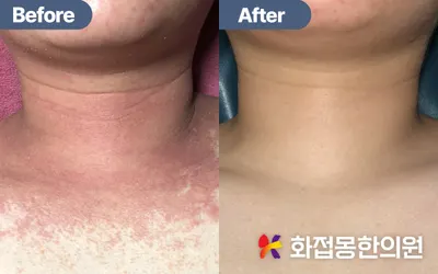 화접몽한의원 — 업체가 네이버 플레이스에 올린 사진 2