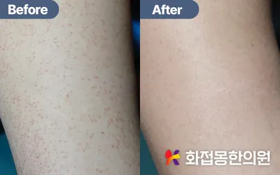 화접몽한의원 — 업체가 네이버 플레이스에 올린 사진 3