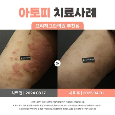 프리허그한의원 — 업체가 네이버 플레이스에 올린 사진 3