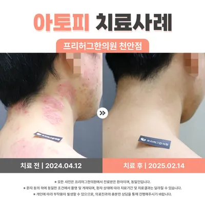 프리허그한의원 — 업체가 네이버 플레이스에 올린 사진 3