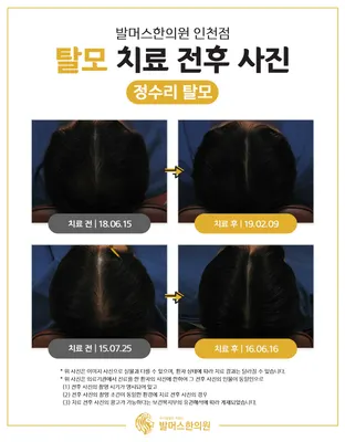발머스한의원 — 업체가 네이버 플레이스에 올린 사진 2