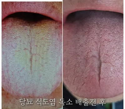 민강한의원 — 업체가 네이버 플레이스에 올린 사진 3