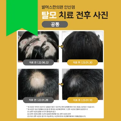 발머스한의원 — 업체가 네이버 플레이스에 올린 사진 2