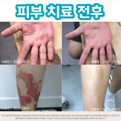 미소로한의원 — 업체가 네이버 플레이스에 올린 사진 3