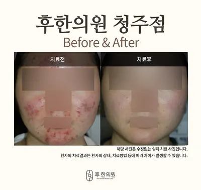 후한의원 — 업체가 네이버 플레이스에 올린 사진 3