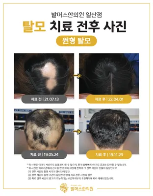 발머스한의원 — 업체가 네이버 플레이스에 올린 사진 3