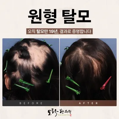 모락한의원 — 업체가 네이버 플레이스에 올린 사진 2