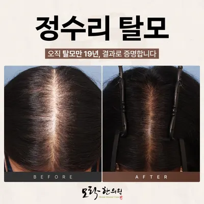 모락한의원 — 업체가 네이버 플레이스에 올린 사진 3