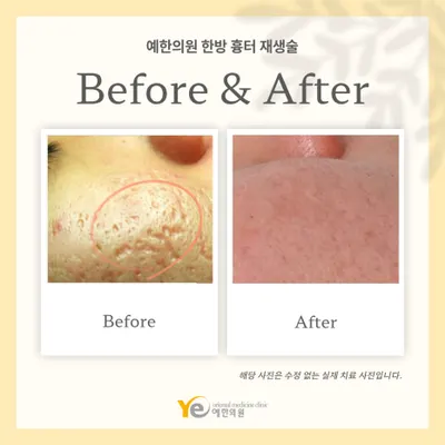 예한의원 — 업체가 네이버 플레이스에 올린 사진 3